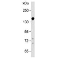 Western blot testing of human liver lysate with Lubricin antibody at 1:500. Predicted molecular weight ~151 kDa.