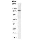 Western blot testing of human lung lysate with CLCA1 antibody at 0.3ug/ml. Predicted molecular weight: ~100/125kDa (unmodified/glycosylated).