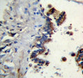 IHC testing of FFPE human lung tissue with Ficolin 3 antibody. HIER: steam section in pH6 citrate buffer for 20 min and allow to cool prior to staining.
