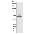 Western blot testing of human spleen lysate with CD79a antibody. Expected molecular weight: 25-47 kDa depending on glycosylation level.