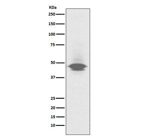 Western blot testing of human spleen lysate with CD79a antibody. Expected molecular weight: 25-47 kDa depending on glycosylation level.