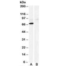 Western blot testing of human heart lysate with Monoamine Oxidase A antibody at 0.3ug/ml with [B] and without [A] the immunizing peptide. Predicted molecular weight: ~60kDa, observed here at ~70kDa.