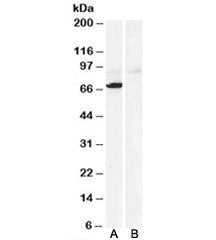 Western blot testing of human heart lysate with Monoamine Oxidase A antibody at 0.3ug/ml with [B] and without [A] the immunizing peptide. Predicted molecular weight: ~60kDa, observed here at ~70kDa.