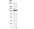 Western blot testing of COL3A1 antibody and Lane 1: HT1080; 2: COLO320 cell lysate. Expected molecular weight ~139 kDa, observed here at ~70 kDa.
