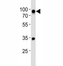 Western blot analysis of lysate from Ramos cell line using CD19 antibody at 1:500. Expected size is 60~100 kDa depending on glycosylation level.