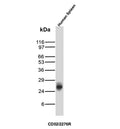 CD52 Antibody Spleen WB. Western blot analysis of CD52 / Campath-1 antigen expression in human spleen tissue lysate using CD52 antibody, clone CD52/2276R. Lane 1: human spleen tissue lysate. A band is detected at approximately 25 kDa, consistent with the predicted molecular weight of CD52, a glycosylphosphatidylinositol-anchored lymphocyte surface protein that can show migration shifts due to glycosylation.