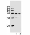 Western blot analysis of lysate from 1) PC3, and 2) LNCaP cell line using VDR antibody at 1:1000. Predicted molecular weight 48/54 kDa (isoforms 1/2).