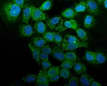 Immunofluorescent staining of FFPE human A431 cells with Annexin A1 antibody (green) and DAPI nuclear stain (blue). HIER: steam section in pH6 citrate buffer for 20 min.