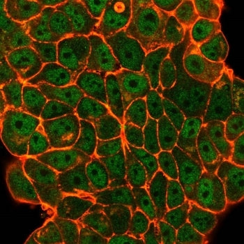 Immunofluorescent staining of PFA-fixed human MCF-7 cells using ELK1 antibody (green, clone PCRP-ELK1-1D9) and phalloidin (red).