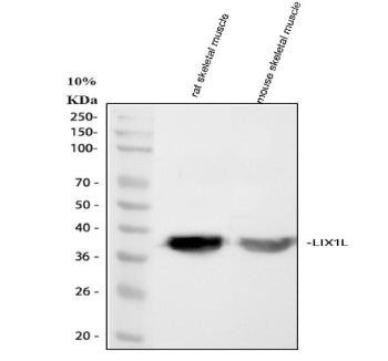Western blot analysis of LIX1L using anti-LIX1L antibody. Lane 1: human SH-SY5Y whole cell lysates, Lane 2: human Jurkat whole cell lysates, Lane 3: human SiHa whole cell lysates, Lane 4: human Hela whole cell lysates. After electrophoresis, proteins were transferred to a nitrocellulose membrane at 150 mA for 50-90 min. Blocked the membrane with 5% non-fat milk/TBS for 1.5 hour at RT.
