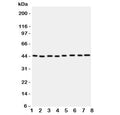 Western blot testing of PGK1 antbody; Lane 1: rat liver; 2: (r) brain; 3: (r) lung; and human samples 4: A431; 5: COLO320; 6: HeLa; 7: A549; 8: Jurkat cell lysate. Expected/observed molecular weight ~44kDa.