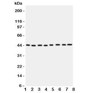 Western blot testing of PGK1 antbody; Lane 1: rat liver; 2: (r) brain; 3: (r) lung; and human samples 4: A431; 5: COLO320; 6: HeLa; 7: A549; 8: Jurkat cell lysate. Expected/observed molecular weight ~44kDa.