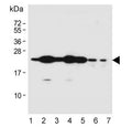 Western blot testing of human 1) HEK293, 2) A549, 3) Hela, 4) T-47D, 5) U-87 MG, 6) mouse liver and 7) rat liver lysate with RAB1B antibody. Predicted molecular weight ~22 kDa.