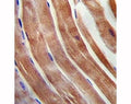 KEAP1 antibody immunohistochemistry analysis in formalin fixed and paraffin embedded human skeletal muscle.
