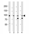 Western blot analysis of lysate from 1) human A431, 2) mouse NIH3T3 cell line, 3) mouse brain and 4) rat brain tissue lysate using Ephb1 antibody at 1:1000.