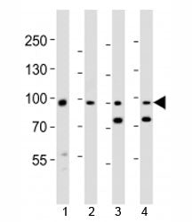 Western blot analysis of lysate from 1) human A431, 2) mouse NIH3T3 cell line, 3) mouse brain and 4) rat brain tissue lysate using Ephb1 antibody at 1:1000.