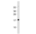 Western blot testing of Chemerin antibody at 1:2000 dilution + human lung lysate. Predicted molecular weight ~19 kDa.