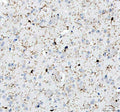 IHC testing of FFPE human spleen tissue with IBA1 antibody. Required HIER: steam section in pH8 EDTA buffer for 20 min and allow to cool prior to testing.