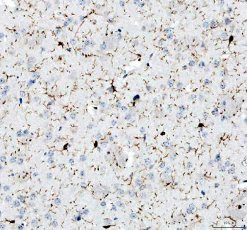 IHC testing of FFPE human spleen tissue with IBA1 antibody. Required HIER: steam section in pH8 EDTA buffer for 20 min and allow to cool prior to testing.