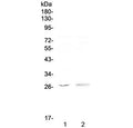 Western blot testing of human 1) MCF7 and 2) COLO320 antibody at 0.5ug/ml. Predicted molecular weight ~27 kDa.