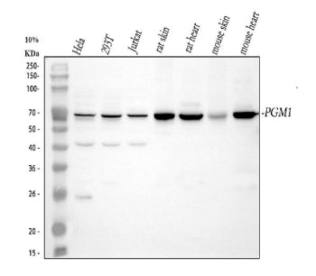 Western blot analysis of PGM1 using anti-PGM1 antibody. Lane 1: human Hela whole cell lysates, Lane 2: human 293T whole cell lysates, Lane 3: human Jurkat whole cell lysates, Lane 4: rat skin tissue lysates, Lane 5: rat heart tissue lysates, Lane 6: mouse skin tissue lysates, Lane 7: mouse heart tissue lysates. After electrophoresis, proteins were transferred to a nitrocellulose membrane at 150 mA for 50-90 min. Blocked the membrane with 5% non-fat milk/TBS for 1.5 hour at RT.