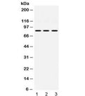 Western blot testing of 1) rat heart, 2) mouse NIH 3T3 and 3) human HeLa lysate with KRIT1 antibody at 0.5ug/ml. Predicted/observed molecular weight: ~84 kDa.