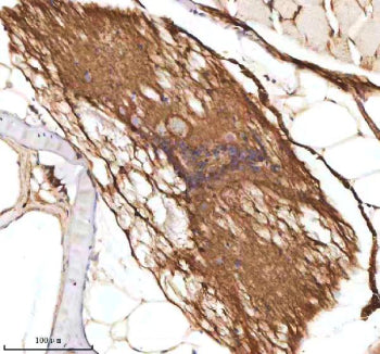 IHC staining of zebrafish Axin2 protein using Zebrafish Axin2 antibody, HRP-labeled secondary and DAB substrate. Axin2 was detected in a paraffin-embedded section of zebrafish spinal cord tissue. HIER: boil tissue sections in pH8 EDTA for 20 min and allow to cool before testing.