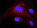 Immunofluorescent staining of FFPE human PC-3 cells with Myeloid cell leukemia 1 antibody (red) and DAPI nuclear stain (blue). HIER: steam section in pH6 citrate buffer for 20 min.