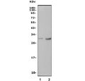 Western blot testing of 1) rat blood and 2) mouse thymus lysate with Cd94 antibody. Expected molecular weight: 19-30 kDa depending on glycosylation level.