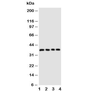 Western blot testing of CD1d antibody and Lane 1: COLO320; 2: HeLa; 3: HT1080; 4: Jurkat cell lysate