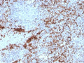 IHC testing of FFPE human spleen with recombinant ITGB3 antibody. Required HIER: boil tissue sections in 10mM Tris with 1mM EDTA, pH9, for 10-20 min followed by cooling at RT for 20 min.
