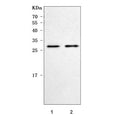 Western blot testing of 1) rat brain and 2) mouse brain tissue lysate with Prolactin antibody. Predicted molecular weight ~26 kDa.