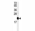 Western blot analysis of Calmodulin antibody and HeLa lysate.
