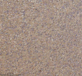 Immunohistochemical staining of TRIM2 using anti-TRIM2 antibody. TRIM2 was detected in a paraffin-embedded section of human glioblastoma tissue. Heat mediated antigen retrieval was performed in EDTA buffer (pH 8.0, epitope retrieval solution). The tissue section was blocked with 10% goat serum. The tissue section was then incubated with 2 ug/ml rabbit anti-TRIM2 antibody overnight at 4oC. Peroxidase Conjugated Goat Anti-rabbit IgG was used as secondary antibody and incubated for 30 min at 37oC.