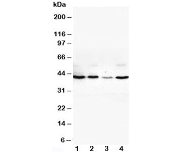 Western blot testing of VEGFD antibody and Lane 1: SW620; 2: COLO320; 3: 6T-CEM; 4: HT1080 cell lysate. Expected molecular weight: 40-53 kDa (pro-form), ~21 kDa (mature/active form).