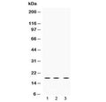 Western blot testing of 1) rat brain, 2) mouse NIH3T3 and 3) human HeLa lysate with LMO1 antibody at 0.5ug/ml. Predicted molecular weight ~18 kDa.