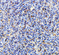 IHC staining of zebrafish Igf2a protein using Zebrafish Igf2a antibody, HRP-labeled secondary and DAB substrate. Igf2a was detected in a paraffin-embedded section of zebrafish liver tissue. HIER: boil tissue sections in pH8 EDTA for 20 min and allow to cool before testing.
