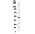 Western blot testing of NIH3T3 lysate with ABHD5 antibody at 0.2ug/ml. Predicted molecular weight: ~39 kDa.