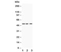 Western blot testing of ANGPTL4 antibody and Lane 1: human placenta; 2: SMMC-7721; 3: HeLa lysate. Predicted molecular weight: ~45 kDa and ~41 kDa, but may be observed at higher molecular weights due to glycosylation.