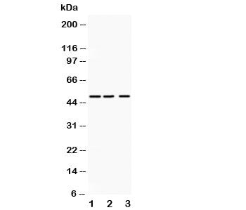 Western blot testing of ANGPTL4 antibody and Lane 1: human placenta; 2: SMMC-7721; 3: HeLa lysate. Predicted molecular weight: ~45 kDa and ~41 kDa, but may be observed at higher molecular weights due to glycosylation.