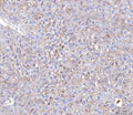 IHC staining of FFPE mouse liver tissue with Poliovirus Receptor antibody. HIER: boil tissue sections in pH8 EDTA for 20 min and allow to cool before testing.