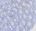 IHC staining of FFPE human stomach (corpus) with BCMA antibody (clone CD269/8125R). HIER: boil tissue sections in pH 9 10mM Tris with 1mM EDTA for 20 min and allow to cool before testing.