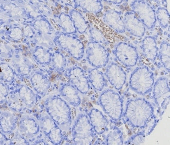 IHC staining of FFPE human stomach (corpus) with BCMA antibody (clone CD269/8125R). HIER: boil tissue sections in pH 9 10mM Tris with 1mM EDTA for 20 min and allow to cool before testing.