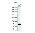 Western blot testing of human brain tissue lysate with PGP9.5 antibody (clone UCHL1/8153). Predicted molecular weight ~25 kDa.