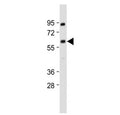 Western blot testing of human MOLT4 cell lysate with YY1 antibody. Predicted molecular weight ~45 kDa but commonly observed at 45~65 kDa.