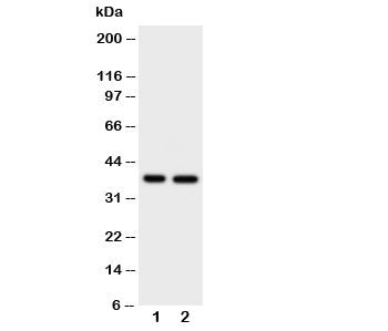 Western blot testing of MCL-1 antibody and Lane 1: HeLa; 2: MCF-7 cell lysate. Predicted molecular weight ~37kDa.