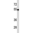 TUBB2A antibody western blot analysis with HEK293 lysate. Predicted molecular weight ~50 kDa.