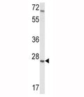 Western blot analysis of IGFBP4 antibody and mouse lung tissue lysate. Predicted molecular weight: ~28kDa.