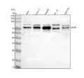 Western blot analysis of SOX9 using anti-SOX9 antibody. Lane 1: human Hela whole cell lysates, Lane 2: human Caco-2 whole cell lysates, Lane 3: human HepG2 whole cell lysates, Lane 4: rat PC-12 whole cell lysates, Lane 5: mouse NIH/3T3 whole cell lysates. After electrophoresis, proteins were transferred to a nitrocellulose membrane at 150 mA for 50-90 min. Blocked the membrane with 5% non-fat milk/TBS for 1.5 hour at RT.