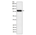 Western blot testing of human tonsil lysate with IgD antibody. Expected molecular weight ~64 kDa but may be observed at higher molecular weights due to glycosylation.